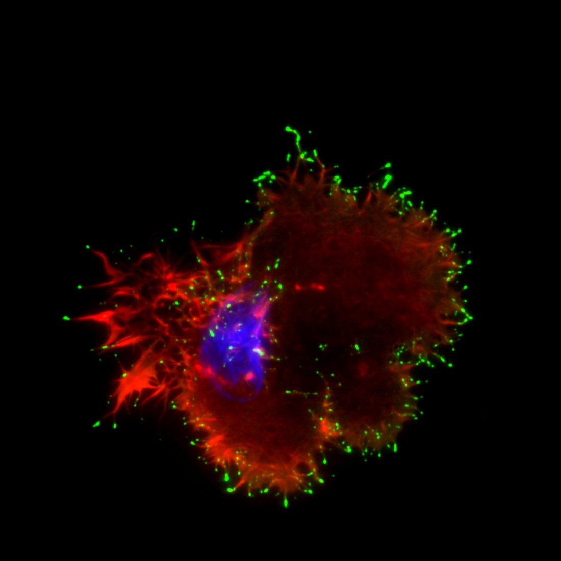 Breast cancer cell labelled for actin (red), Myosin-X (green) and DAPI (to visualise the nucleus, blue).