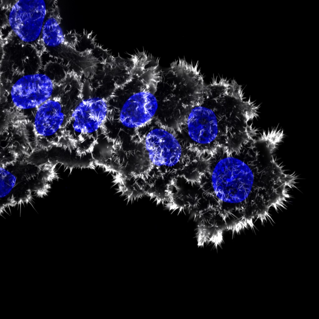 Breast cancer cells invading through collagen. The actin cytoskeleton (white) and the nuclei (blue) are labelled.