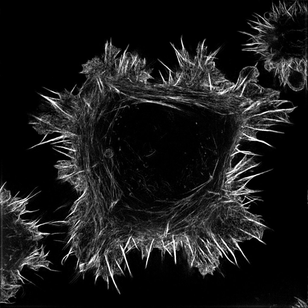 Breast cancer cells plated on fibronectin, labelled to visualize the actin cytoskeleton and imaged using structured illumination microscopy.