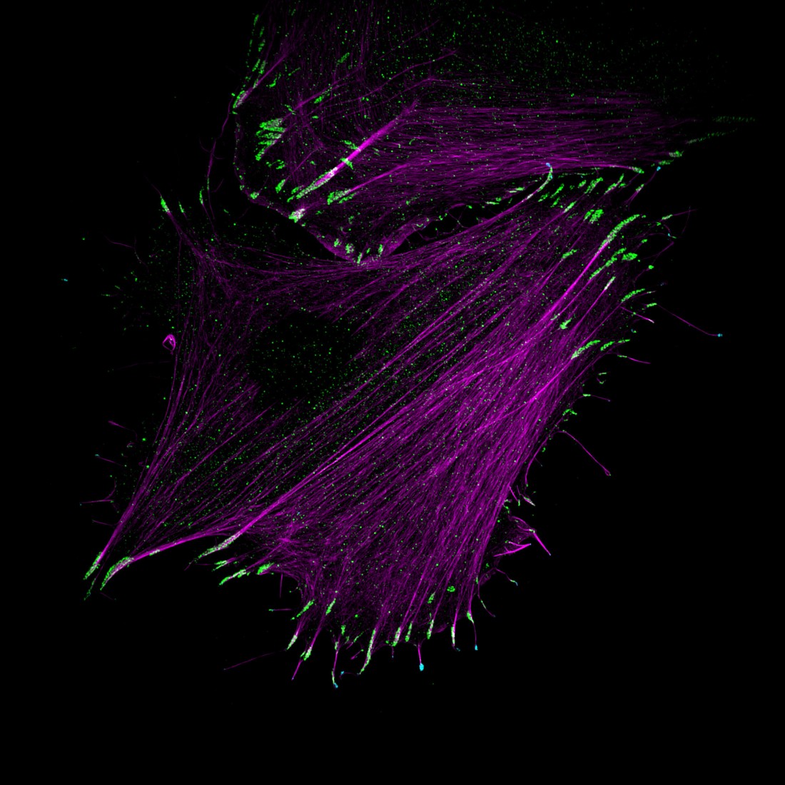 An osteosarcoma cell labelled to visalyse the actin cytoskeleton (magenta), paxillin (green) and Myosin-X (cyan). Image acquired using a structured illumination microscope.